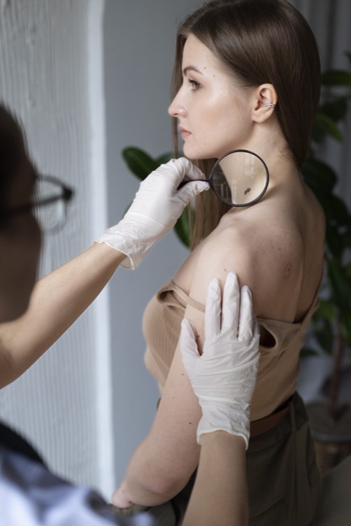 Consultation dermatologique